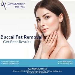 Buccal Fat Removal, Chubby Cheeks Surgery in Delhi