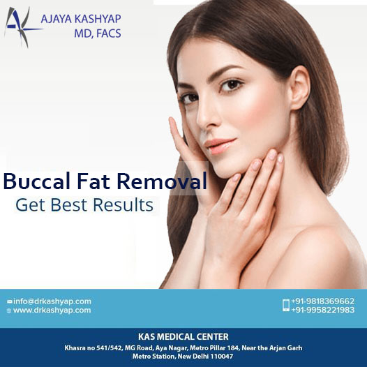 Buccal Fat Removal, Chubby Cheeks Surgery in Delhi - InterestPin ...