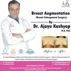 Consult the best Breast Augmentation Surgeon in India