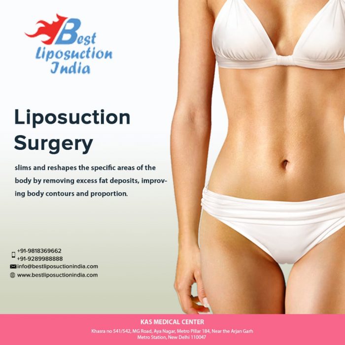 Best Liposuction Surgeon in Delhi : Dr. Ajaya Kashyap