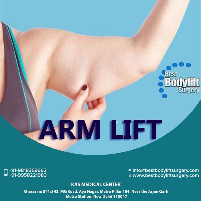 Best Arm Lift Surgery in Delhi, Brachioplasty Procedure Cost in India