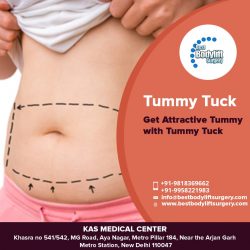 Are You Looking Tummy Tuck Surgeon Clinic in Delhi