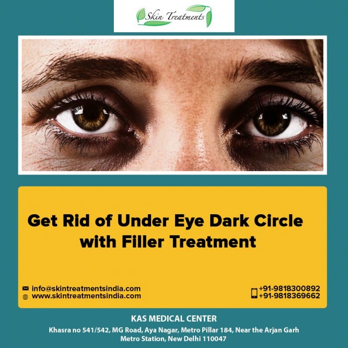 Get Under Eye Dark Circle Treatment in Delhi