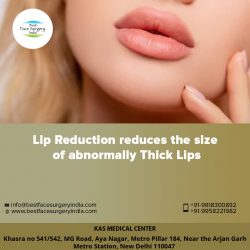 Lip Reduction Procedure in delhi