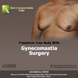 Best Gynecomastia Surgeon Clinic in Delhi