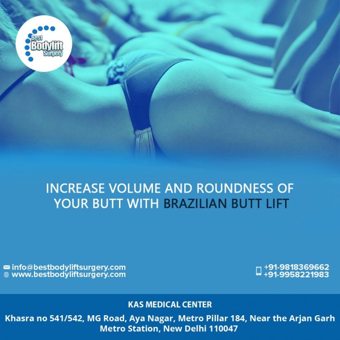 Brazilian Butt Lift Surgery Cost in India – Cosmetic Surgery Clinic in Delhi