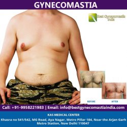 Best Male Breast Reduction Surgeon India