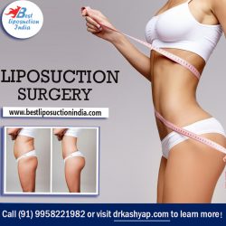 Learn more about Liposuction by Dr Kashyap Triple American Board Certified Plastic Surgeon in India