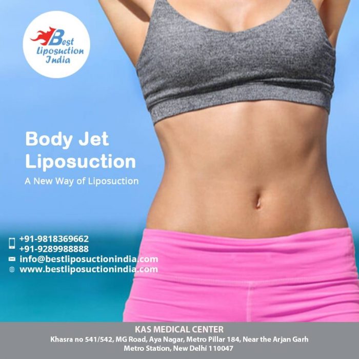 Body Jet Liposuction Surgery by US Board Certified Surgeon Dr. Kashyap in Delhi