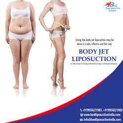 Body Jet Liposuction Surgery Clinic in Delhi – Bestliposuctionindia.com