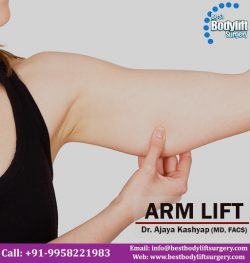Arm Lift Surgery in Delhi – Bestbodyliftsurgery.com