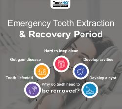 Emergency Tooth Extraction and Recovery Period