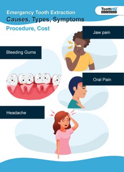 Emergency Tooth Extraction: Causes, Types, Symptoms, Procedure, Cost