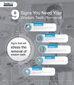 9 Signs You Need Your Wisdom Teeth Removed