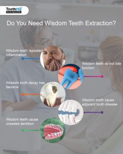 What Should I Pay Attention to After Wisdom Teeth Extraction?
