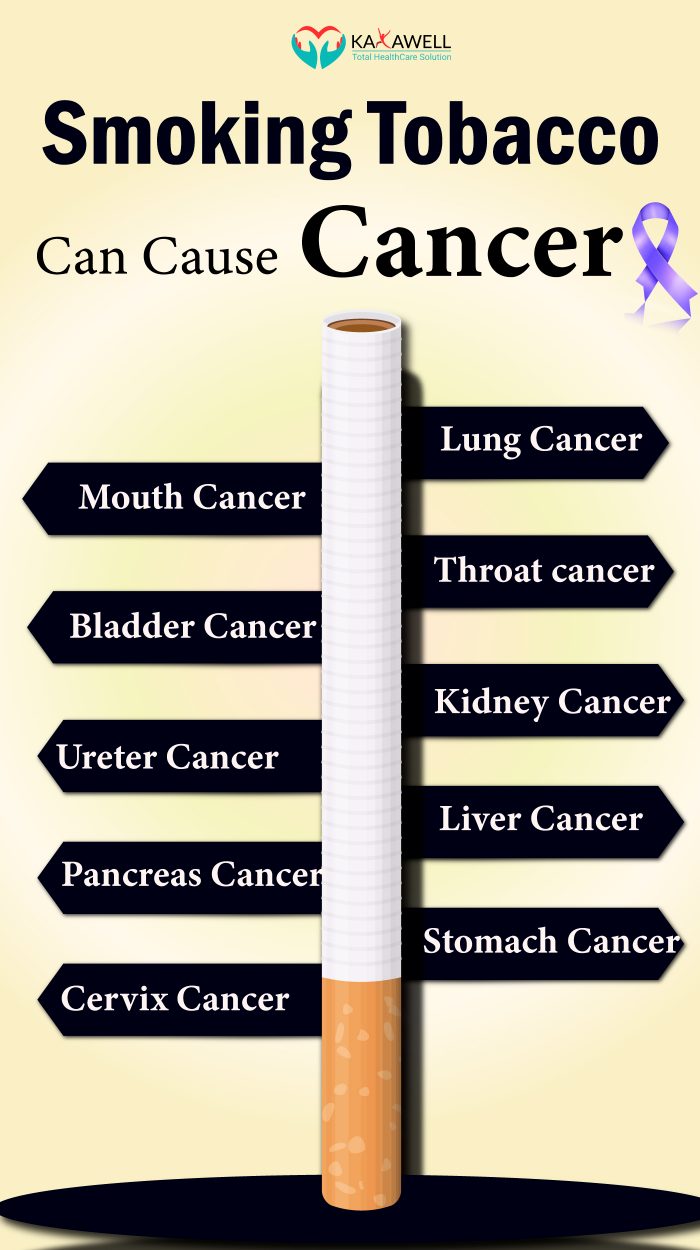 Smoking Tobacco Can Cause Cancer