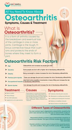 Osteoarthritis Treatment, Symptoms, Signs & Causes