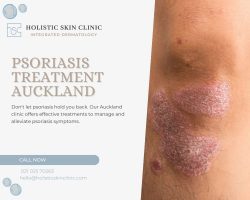 Effective Psoriasis Treatment in Auckland