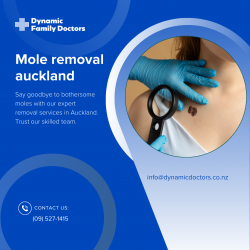 Safe and Effective Mole Removal in Auckland – DynamicDoctors.co.nz