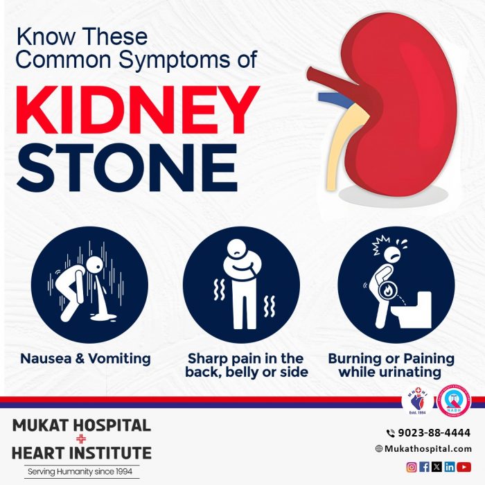 Kidney Stone Symptom | Mukat Hospital