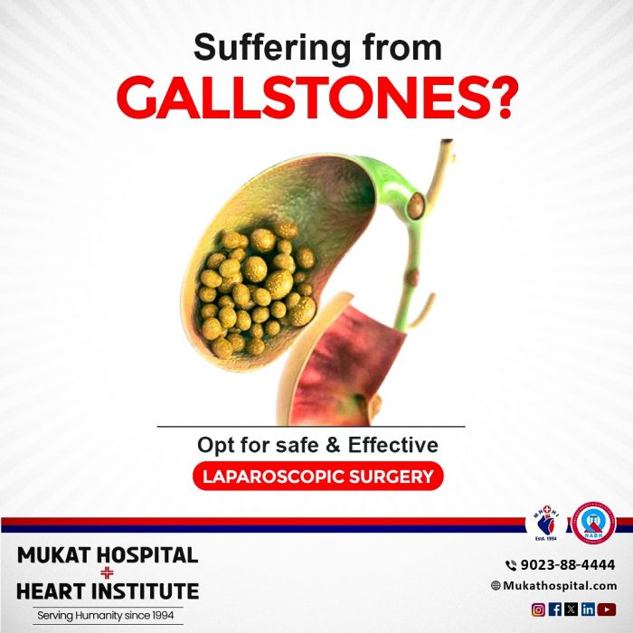 Gallstones Surgery | Gallstones Treatment | Mukat Hospital