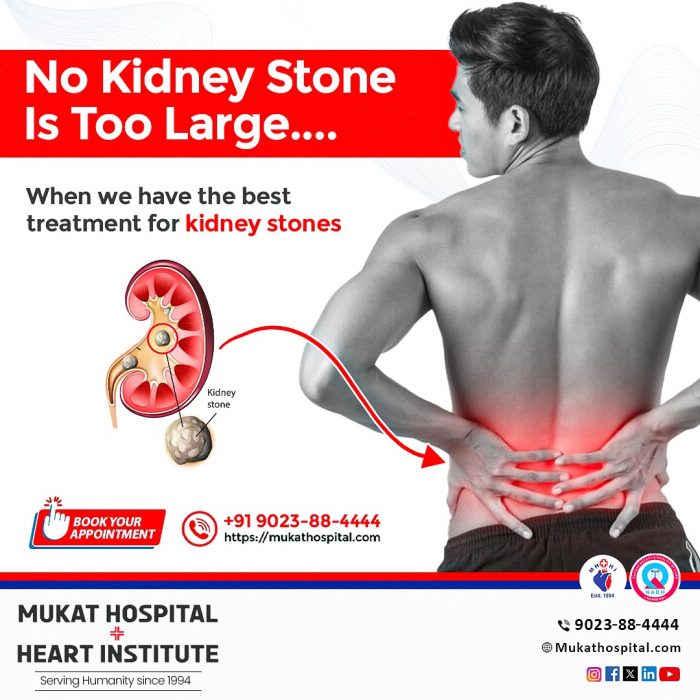 Treatment for Kidney Stone in Chandigarh | Mukat Hospital