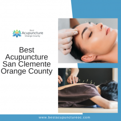 Best Acupuncture San Clemente Orange County