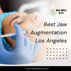 Best Jaw Augmentation Los Angeles