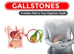 Gallstones: A Hidden Risk to Your Digestive Health