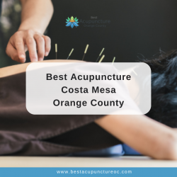 Best Acupuncture Costa Mesa Orange County