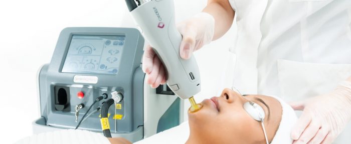Say Goodbye to Shaving with Full Face and Neck Laser Hair Removal Today