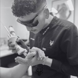 Men’s Laser Hair Removal Castle Hill – BareWolf