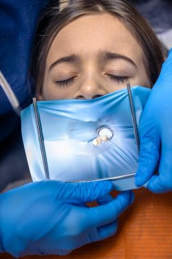 Get Comfortable Care from Our Dentist Wisdom Tooth Extraction Team
