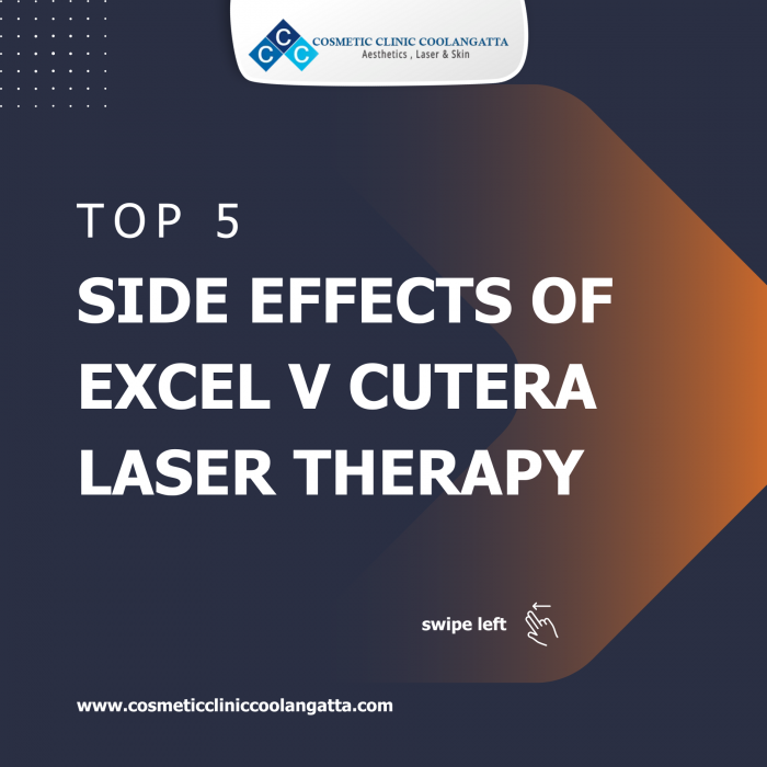 Top 5 Side Effects of Excel V Cutera Laser Therapy