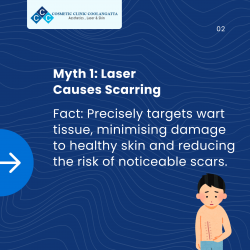 Myth 1: Laser Causes Scarring