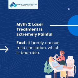 Myth 2: Laser Treatment Is Extremely Painful