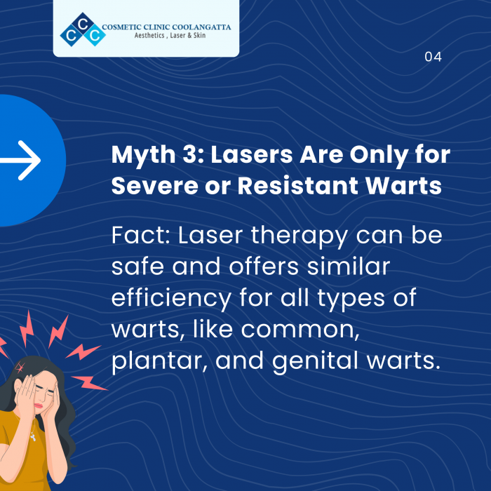 Myth 3: Lasers Are Only for Severe or Resistant Warts