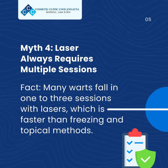 Myth 4: Laser Always Requires Multiple Sessions