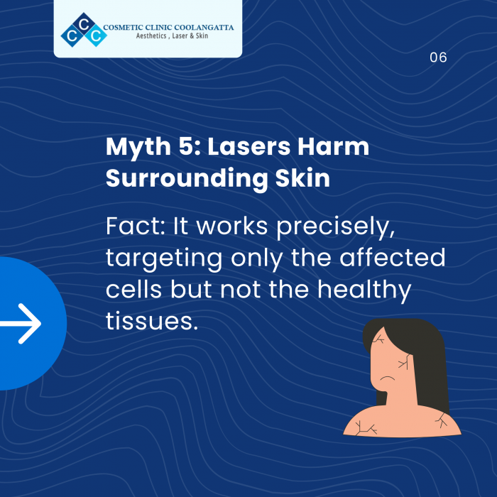 Myth 5: Lasers Harm Surrounding Skin