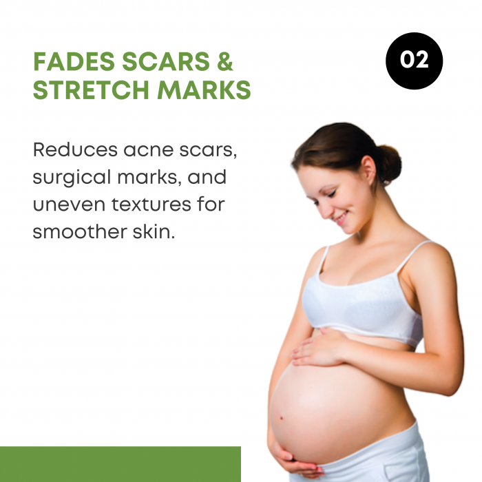 2. Fades Scars & Stretch Marks