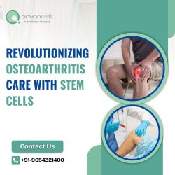 Revolutionizing Osteoarthritis Care with Stem Cells