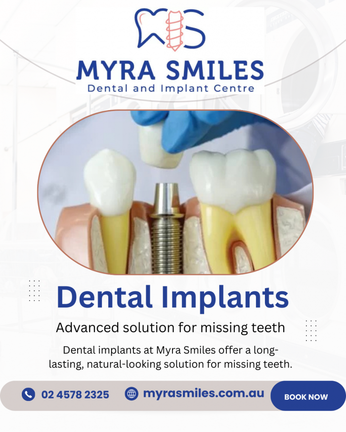 Permanent Tooth Replacement Options with Modern Dental Implants – Myra Smiles Dental and Implant ...
