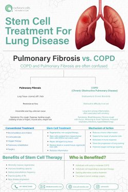 Stem Cell Treatment for Lung Disease