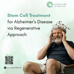 Stem Cell Treatment for Alzheimer’s Disease via Regenerative Approach