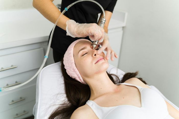 Why Choose a Carbon Facial in Melbourne