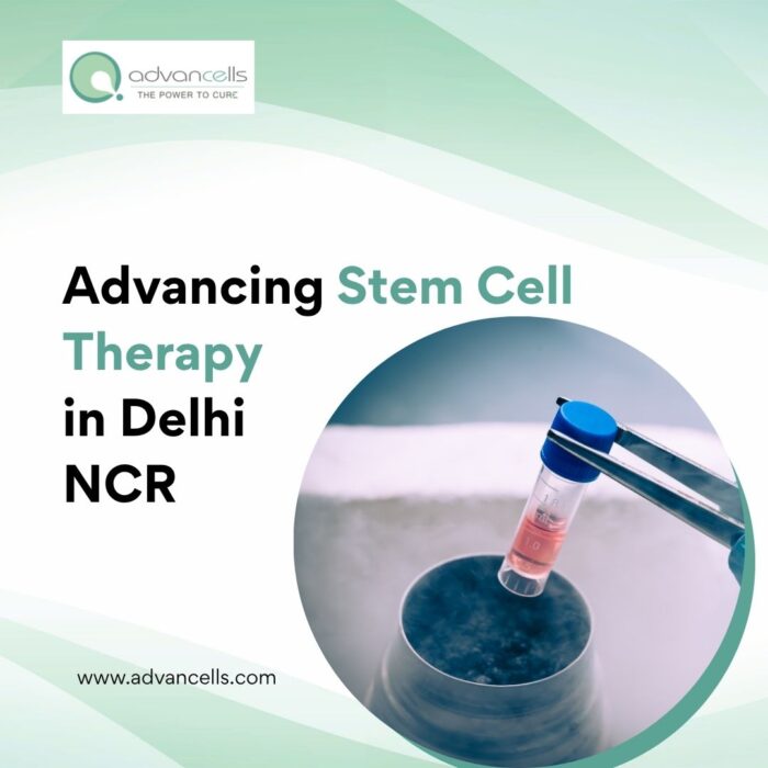 Advancing Stem Cell Therapy in Delhi NCR