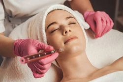Skin Needling: A Proven Approach to Smoother Skin and Refined Pores
