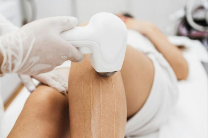RF Skin Tightening: Non-Surgical Face Lifting Solutions Available in Melbourne