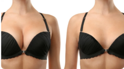 best breast cancer surgeon in pune for Expert Surgical Care