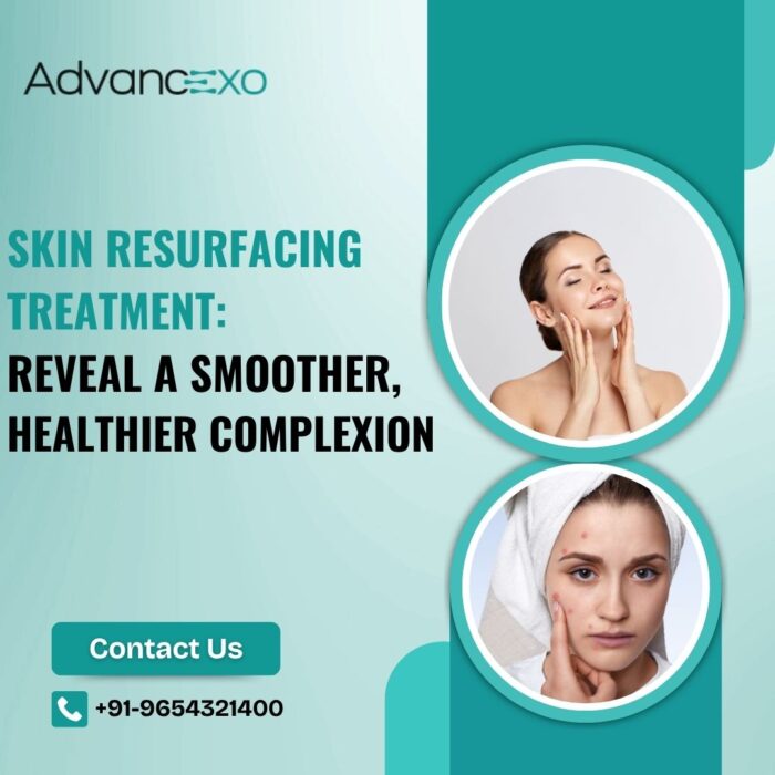Skin Resurfacing Treatment: Reveal a Smoother, Healthier Complexion